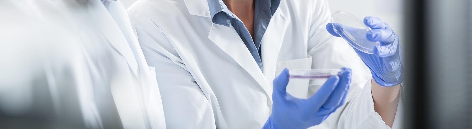 Lebensmittelproben in der Großküche